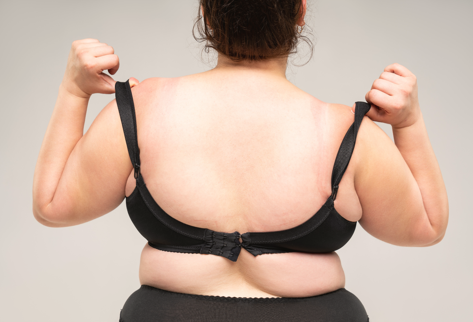 Top Features to Look for in a Comfortable Bra: Woman wearing an uncomfortable bra with straps digging into her skin, showing the discomfort caused by a poor fit.